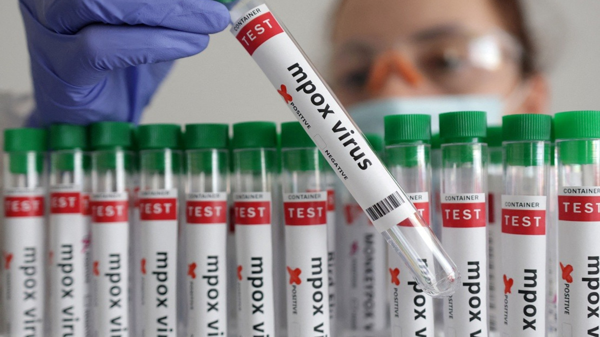 Guinea-Bissau Reports First Mpox Case as Health Authorities Mobilise Response