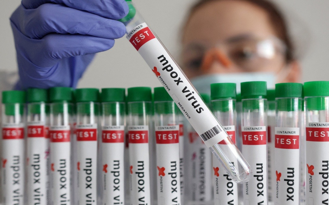 Guinea-Bissau Reports First Mpox Case as Health Authorities Mobilise Response