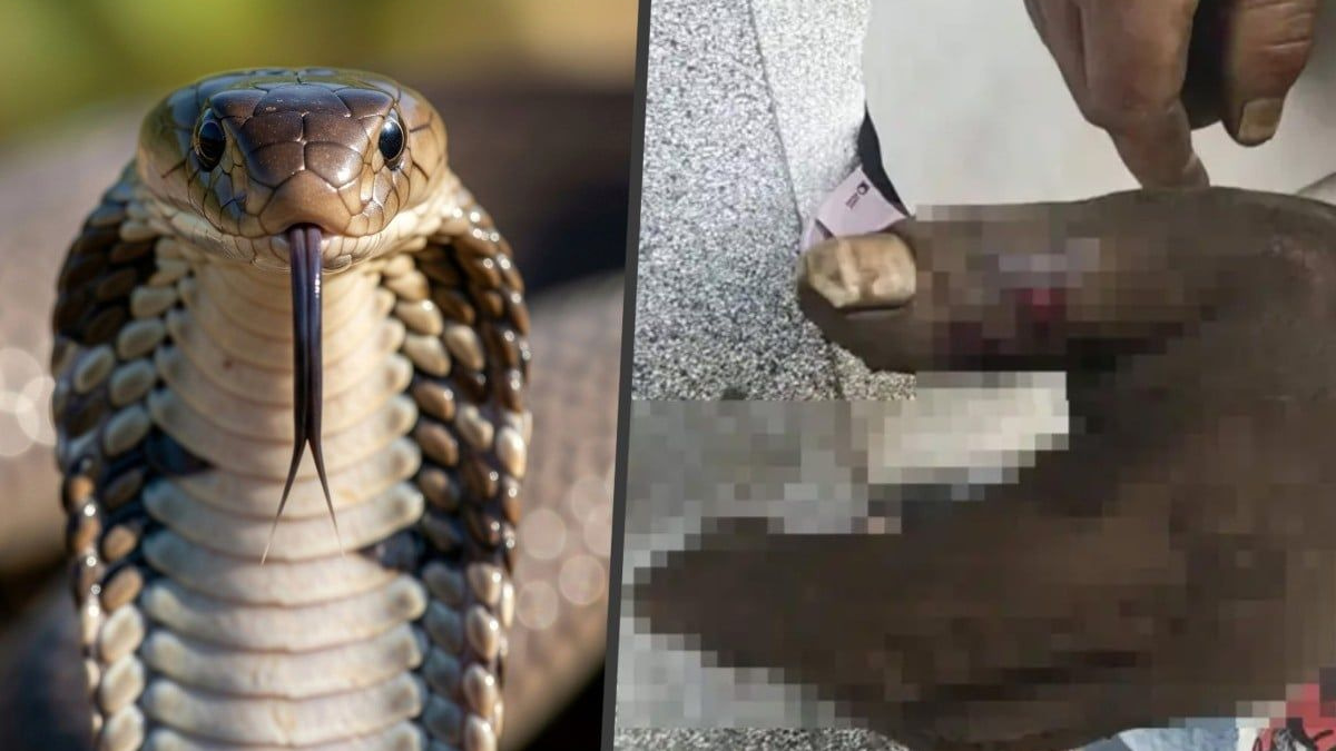 Woman Poisons Herself Trying to Save Husband from Cobra Bite in China