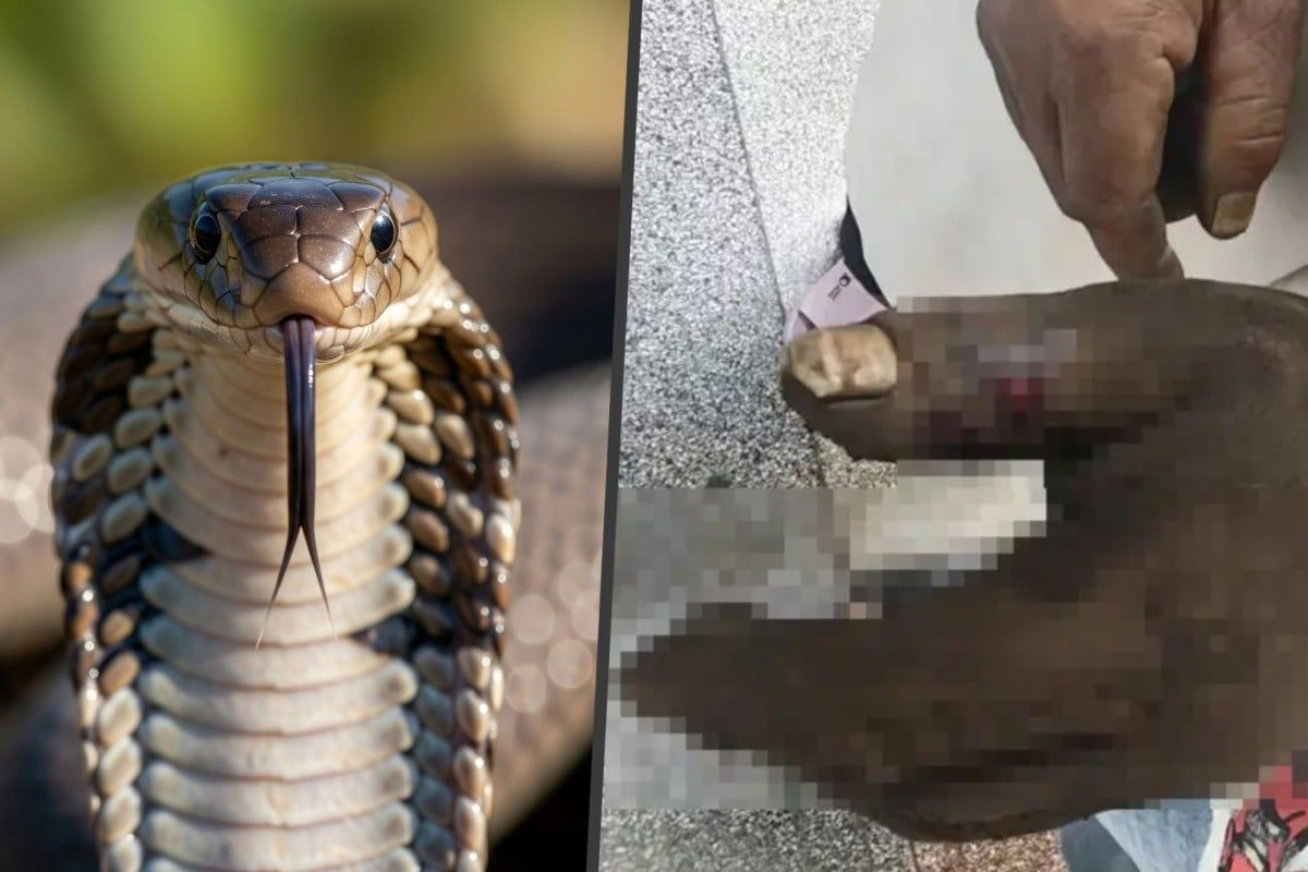 Woman Poisons Herself Trying to Save Husband from Cobra Bite in China