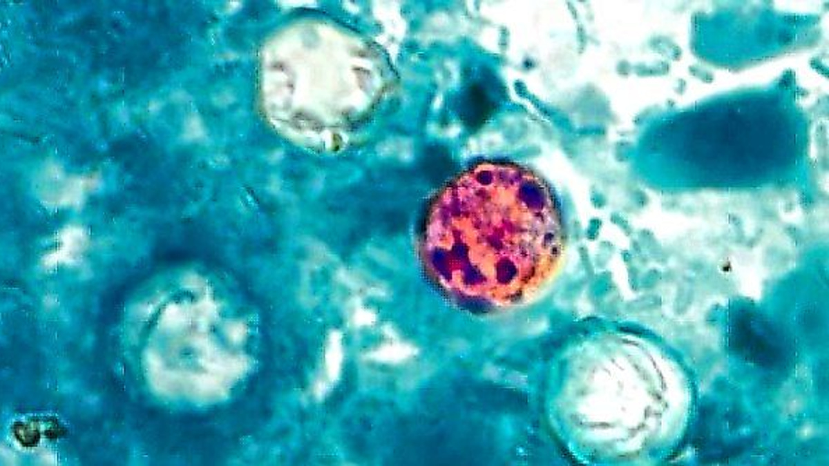 The Detection Puzzle: Why Cyclospora Outbreaks Are So Hard to Trace and Control