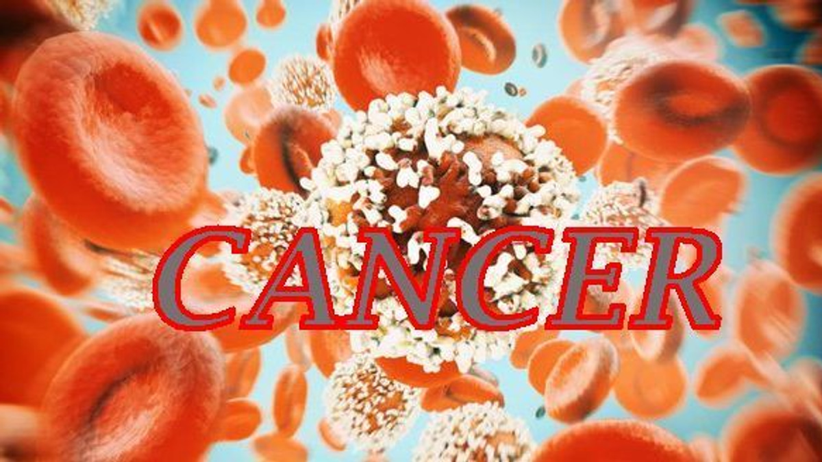 The Silent Threat: Why Young People Are Increasingly Developing Colorectal Cancer