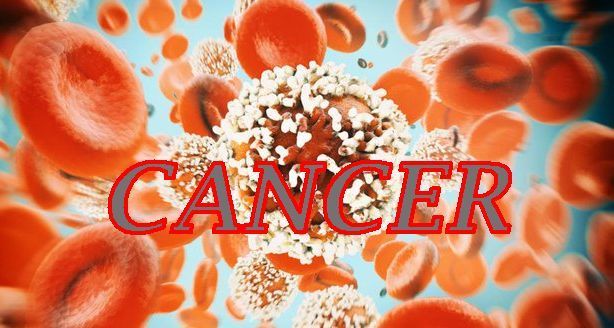 The Silent Threat: Why Young People Are Increasingly Developing Colorectal Cancer
