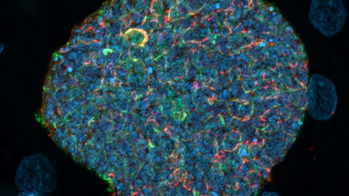 Australian Scientists Develop Novel Malaria Strategy Using Mosquito Bites as Immune Boosters