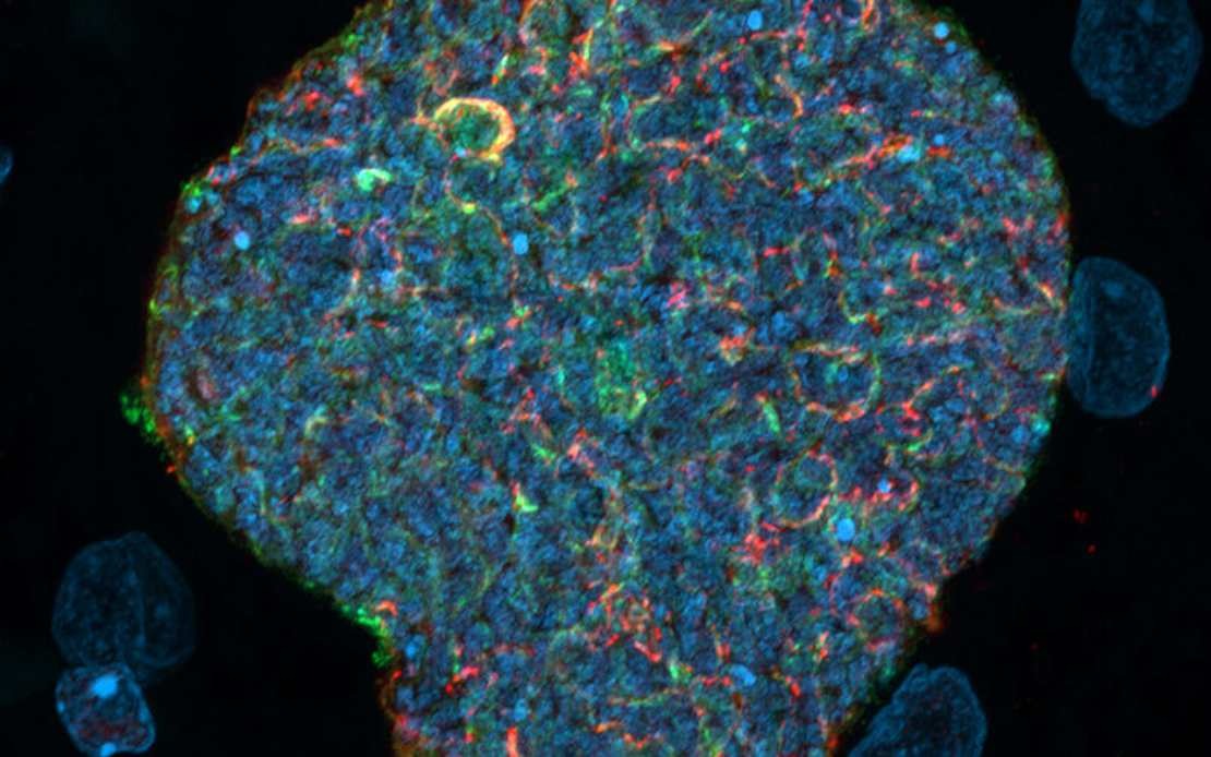 Australian Scientists Develop Novel Malaria Strategy Using Mosquito Bites as Immune Boosters