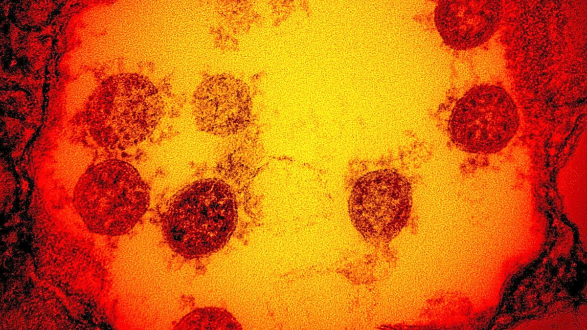 Cambridge Scientists Develop 'Master Key' AI Vaccine to Fight Multiple Virus Families