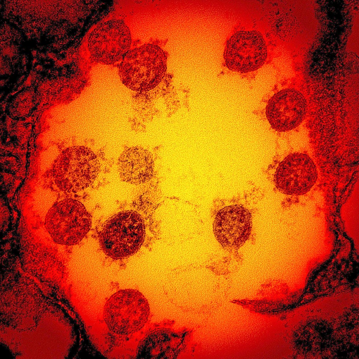 Cambridge Scientists Develop 'Master Key' AI Vaccine to Fight Multiple Virus Families
